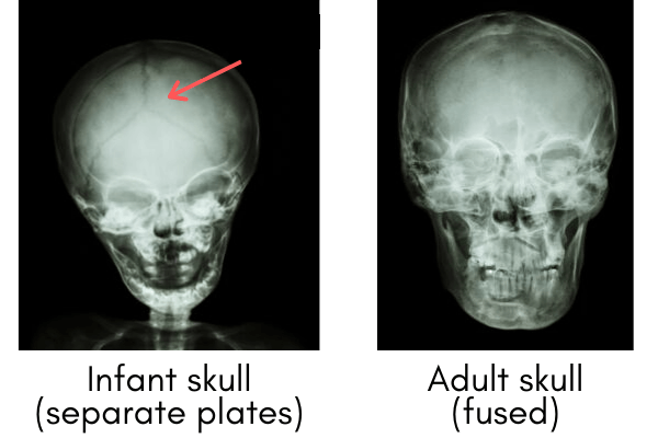 Infant skull vs. adult skull